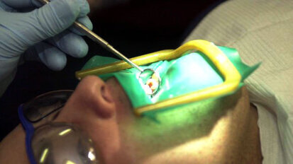 Все по-малко пациенти се притесняват от ендодонтското лечение