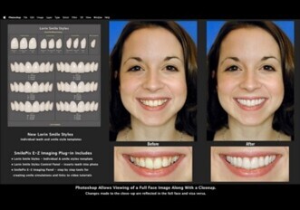 SmilePix E-Z Imaging