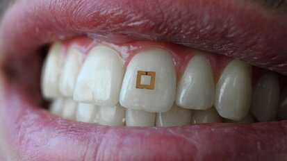 Microchip op tand meet inname suiker, zout en alcohol