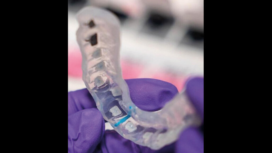 Bonding digitale 3M: vi invitiamo a scoprire le innovazioni per un bonding ortodontico preciso ed efficiente