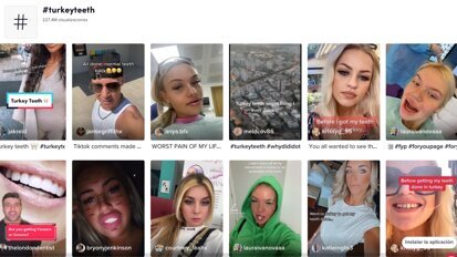 La locura de los dientes turcos o 