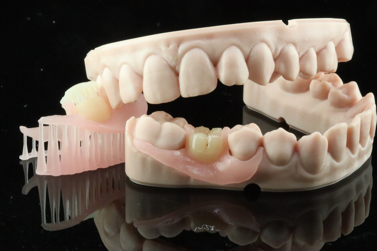 Fig. 3b: Final flexible partial denture checked on a printed model.