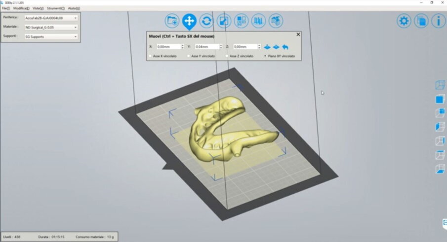 Figg. 29, 32_3DDLP software.
