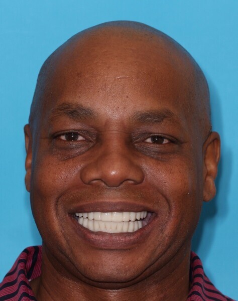 Fig. 24: Full-face view of the try-in Flexcera Smile final prostheses duplicates, confirming improved aesthetics and function.