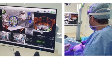 University College of Dentistry workshop demonstrates All-on-4 implants