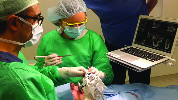 Dynamic navigation for dental implants: Navident at EAO