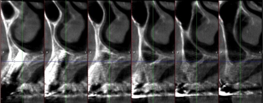 Fig. 2 - Cross section di zona 23.