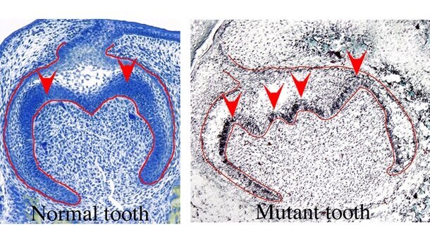 Notwendiges Gen für die Zahnbildung entdeckt