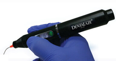 DentaLaze: new, cost-effective, wireless, soft-tissue diode laser