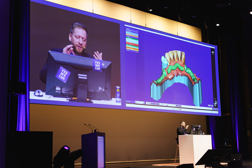 PartialCAD and snap-ons were the topics introduced by Joh Haerich, Application Specialist at exocad.