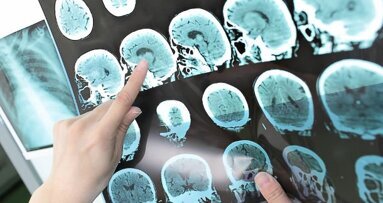 Споменът от денталното лечение преследва съзнанието на неспокойните пациенти