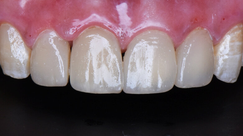 The Dentsply Sirona Global Clinical Case Contest 2018-2019