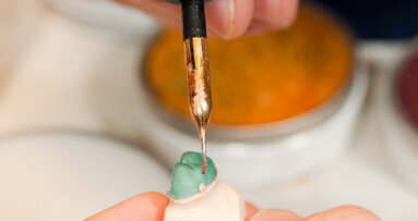 日本种植手术治疗失败率高