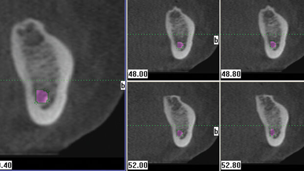 Cone beam — awareness in three dimensions