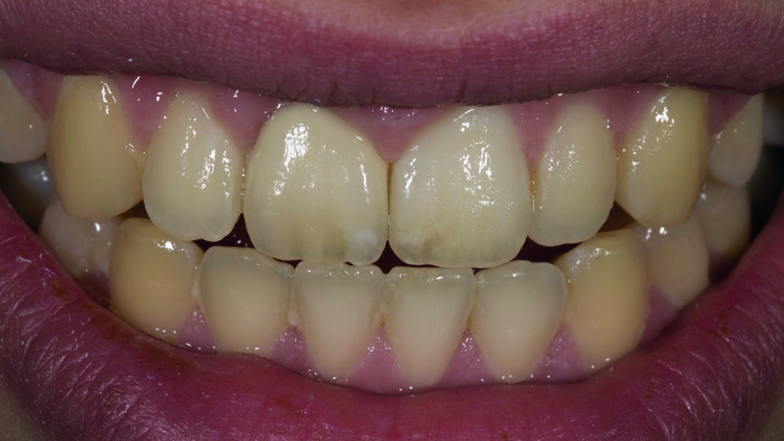 Fig. 13 : Ímage en gros plan du résultat final. 