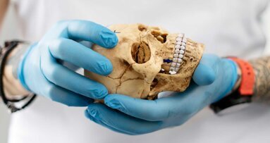 Nose, Sinus & Implants: Humanpräparatekurs und Weichgewebemanagement