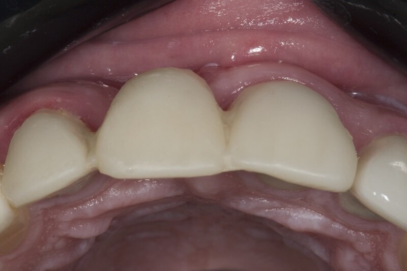 Ryc. 2_Stan pierwotny.