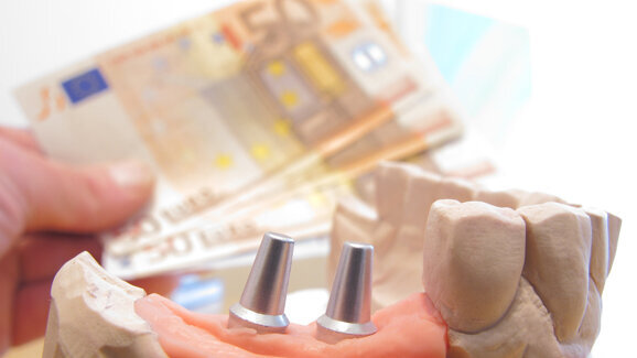 Patientenstudie: Zahnersatz wird oft finanziert
