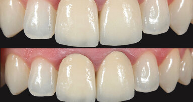 Precisión del color con una nueva cerámica