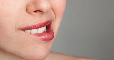 Au Backe! Das sind die Zahnprobleme der Deutschen