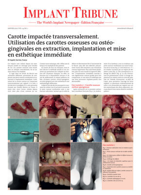 Implant Tribune France No. 1, 2022