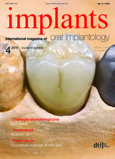 implants Poland No. 4, 2016