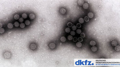 Biomarker für virusbedingten Krebs im Rachenraum gefunden Biomarker für virusbedingten Krebs im Rachenraum gefunden