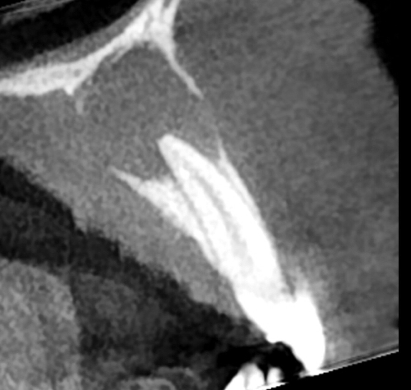 Fig. 2d: Original image.