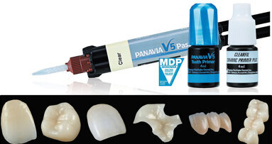 ΟΔΗΓΟΣ ΓΙΑ ΤΗΝ ΕΠΙΤΥΧΗ ΣΥΓΚΟΛΛΗΣΗ ΠΡΟΣΘΕΤΙΚΩΝ ΑΠΟΚΑΤΑΣΤΑΣΕΩΝ