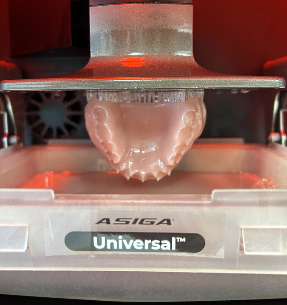 The efficiency of 3D printing enables Tanya Little and her team to streamline their workflow, reducing turnaround times and allowing them to provide their patients with dentures in a timely manner.