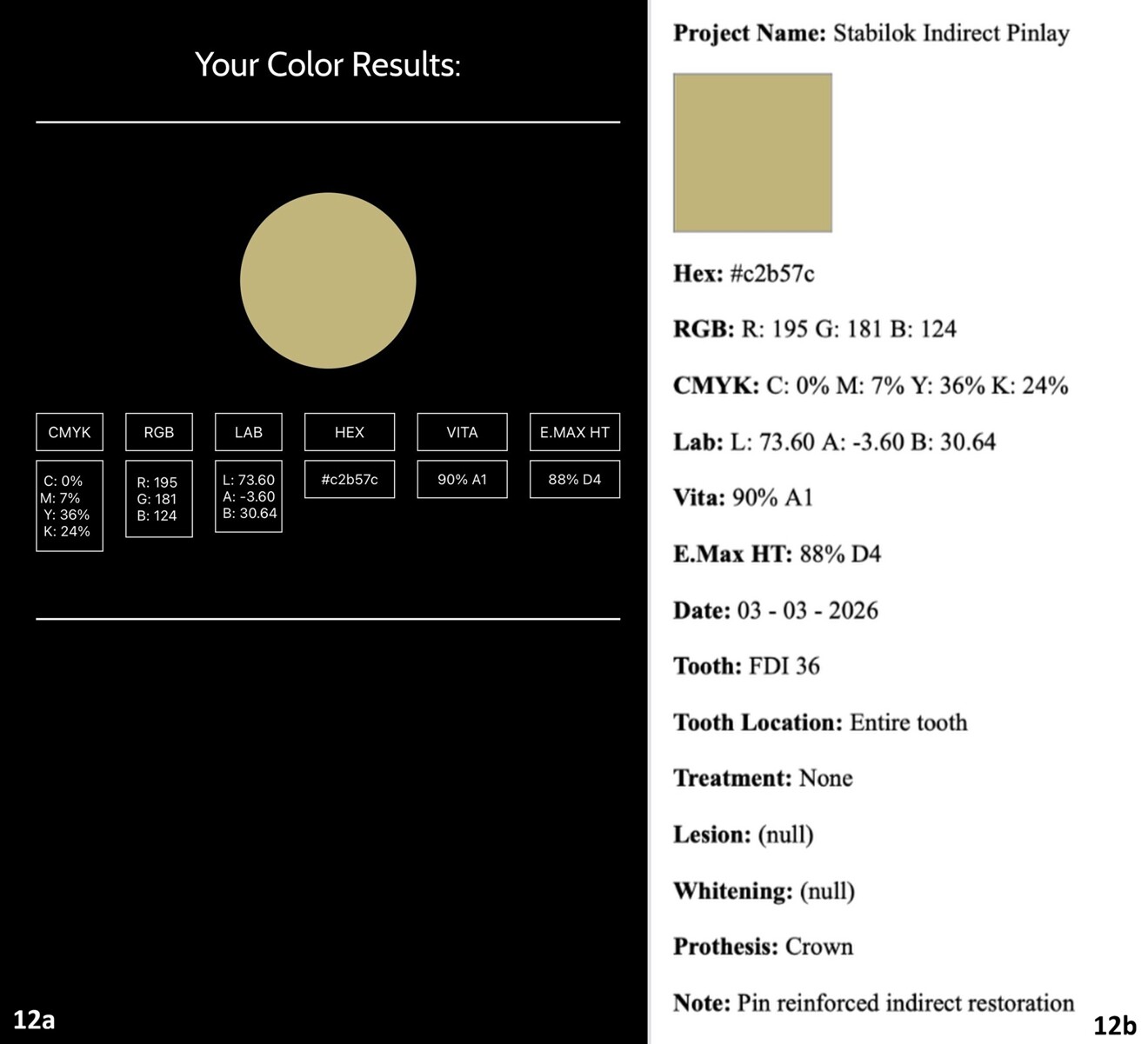 Figs. 12a & b: SmileShade assessment of the dentoform tooth, showing a 90% match to Shade A1 (a), and the generated documentation page for the pinlay project (b).