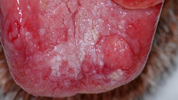 Oral cancer patient sues dentist