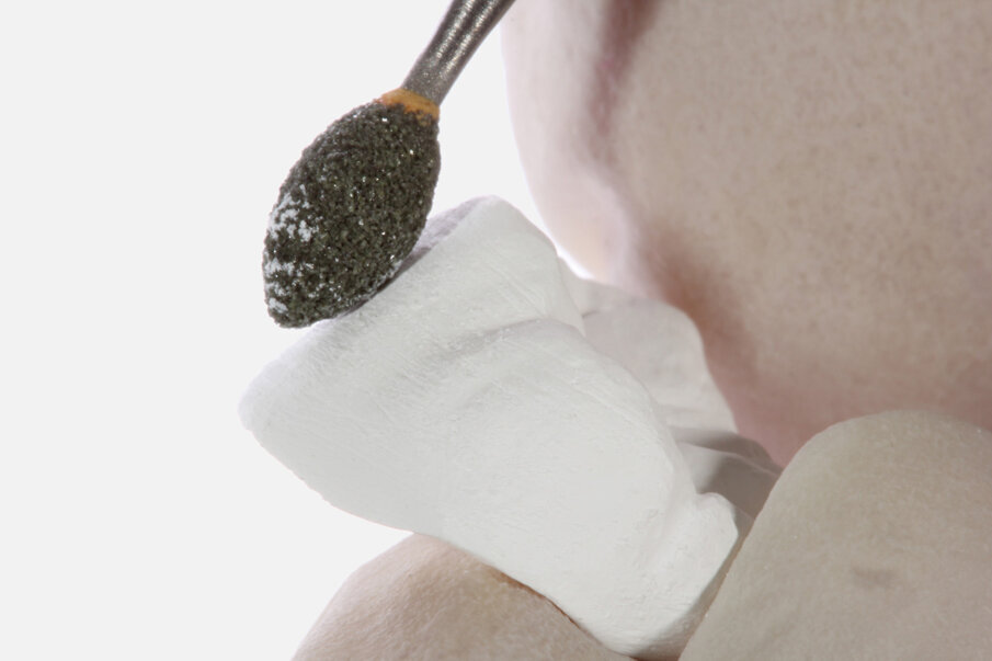 Fig. 6: Stones and sandpaper cones were drawn over the surface by hand without rotation.