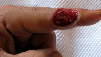 Biomateriał nowej generacji nagrodzony na wystawie innowacji