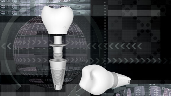 Dental genial: Digitale Praxis und Labor im Fokus der IDS 2013