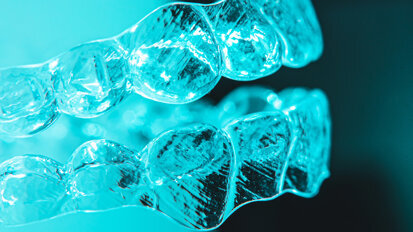 Global clear aligner market: The stars are aligned