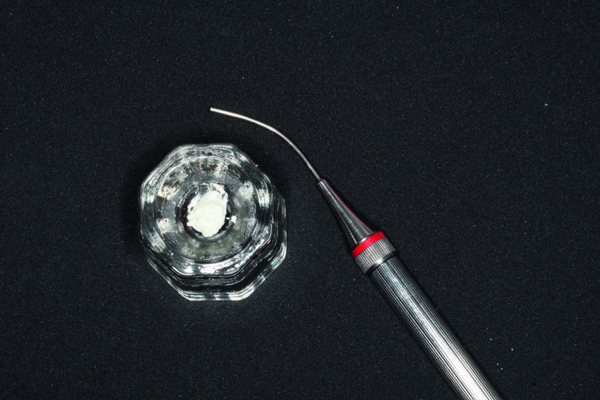 Fig. 3: MAP System carrier with prepared MTA