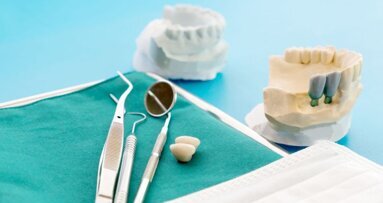 Mening publiek over implantaten