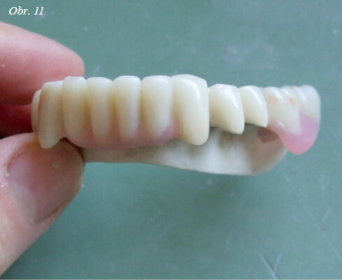 Obr. 11