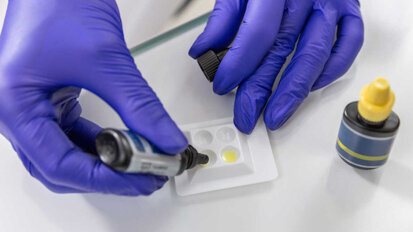 Estudo compara a capacidade de penetração de selantes na dentina e métodos de obturação