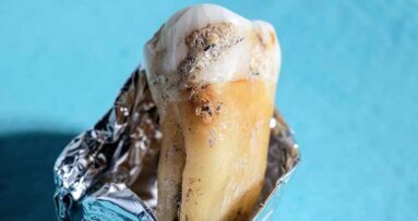 Die Entwicklungsgeschichte unserer Mundflora