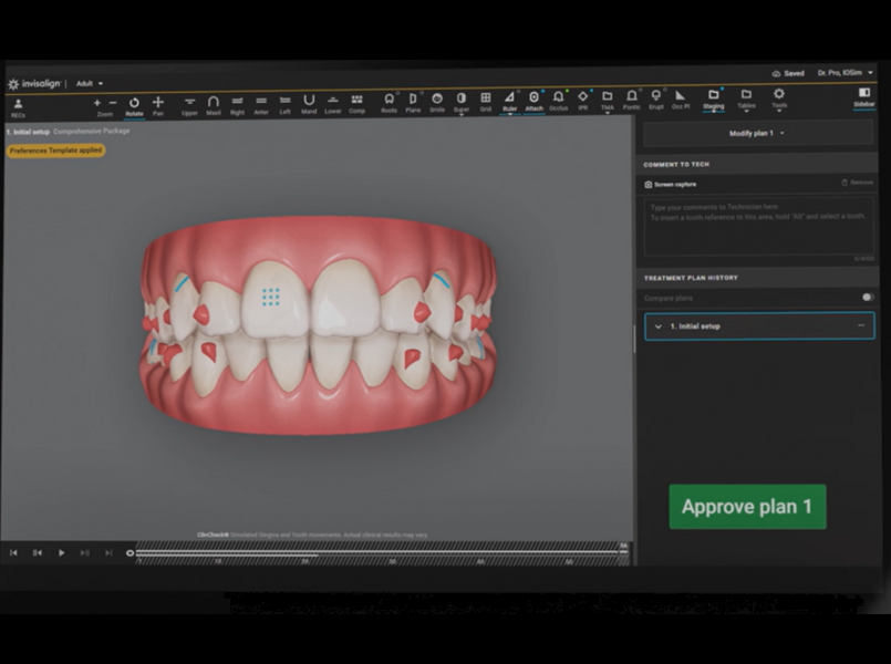 ClinCheck Live Plan will allow clinicians to receive many initial treatment plans within minutes, accelerating case turnaround.*