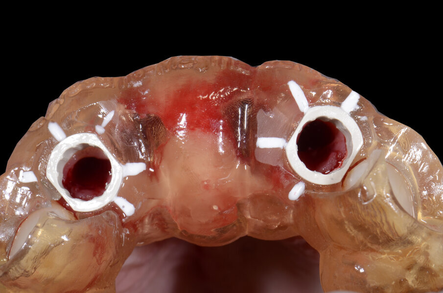 Fig. 24 - Visione Occlusale.