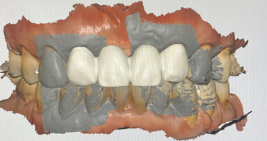 Digitalisation for the conventional and analogue dentist: Ten key points