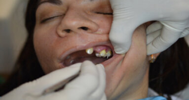 Indicaciones postquirúrgicas