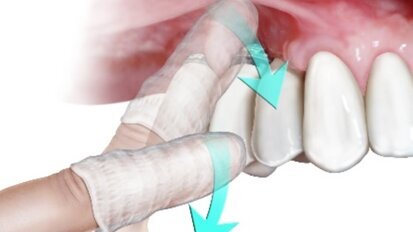 Un protocollo semplice ed efficace con l’obiettivo di prevenire il contagio da Coronavirus