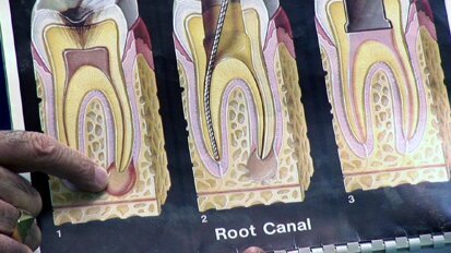 Ξεκινά την επόμενη Παρασκευή το πρώτο Συνέδριο Ενδοδοντίας και Προσθετικής