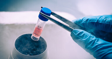 Stem cells from primary teeth may help repair adult teeth, study finds