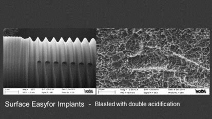 Valutazione a 12 mesi  degli impianti Easyfor cilindrici secondo i criteri di successo/insuccesso descritti in letteratura. Studio prospettico multicentrico. Analisi su 50 casi