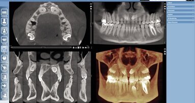 Planmeca software allows multiple applications for dental facilities